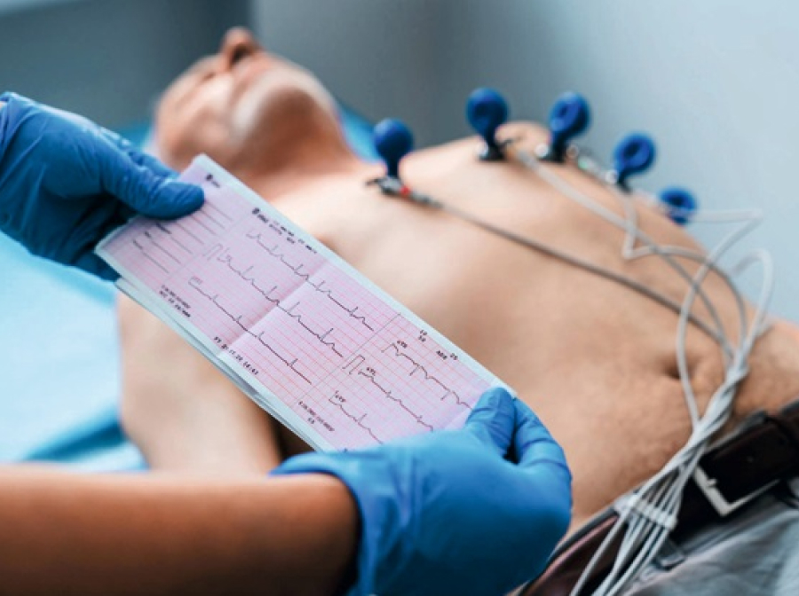 ECG